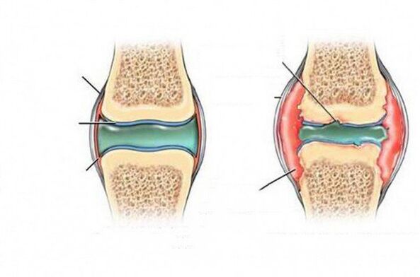 The deformation process of the joint